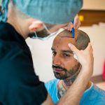 TrawellMed: Haartransplantation in der Türkei weit über den Standards auf der Welr